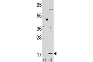 Western blot analysis of LC3 II antibody and 293 lysate transiently transfected with the LC3B gene (2ug/lane).