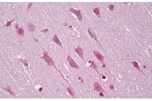 Anti-EFNA5 / Ephrin A5 antibody IHC staining of human brain, cortex neurons. (Ephrin A5 抗体  (AA 31-80))
