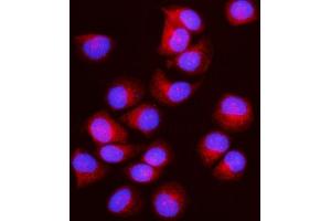 IF analysis of IFT43 using anti-IFT43 antibody (ABIN7599083). (IFT43 抗体  (AA 1-208))