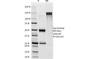 SDS-PAGE Analysis Purified CD28 Mouse Monoclonal Antibody (C28/76). (CD28 抗体)