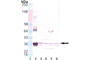 Western blot analysis of HO-2, pAb: Lane 1: MW marker, Lane 2: HO-2 Recombinant Human Protein , Lane 3: Human Liver Microsome Extract, Lane 4: Mouse Liver Microsome Extract, Lane 5: Rat Liver Microsome Extract, Lane 6: Dog Liver Microsome Extract. (HMOX2 抗体  (N-Term))