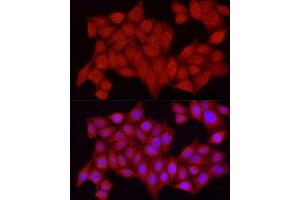 Immunofluorescence analysis of HeLa cells using [KO Validated] PTPN2 Rabbit pAb (ABIN3022584, ABIN3022585, ABIN3022586, ABIN1513448 and ABIN6218927) at dilution of 1:250 (40x lens). (PTPN2 抗体  (AA 1-353))