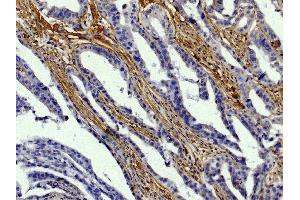 Immunohistochemistry (IHC) image for anti-Collagen, Type I (COL1) antibody (Biotin) (ABIN135047)