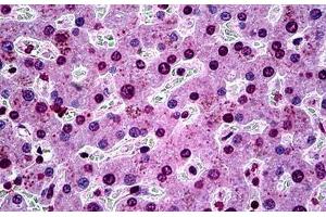 Human Liver: Formalin-Fixed, Paraffin-Embedded (FFPE) (SGK1 抗体  (AA 1-91))