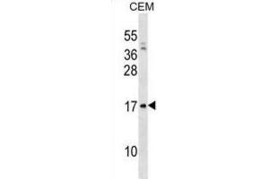 Western Blotting (WB) image for anti-Pre-B Lymphocyte 1 (VPREB1) antibody (ABIN3000848) (VPREB1 抗体)