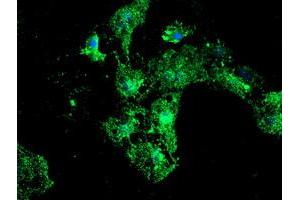 Anti-PSMB9 mouse monoclonal antibody (ABIN2455595) immunofluorescent staining of COS7 cells transiently transfected by pCMV6-ENTRY PSMB9 (RC209001). (PSMB9 抗体  (AA 21-219))