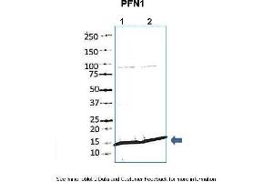 Western Blotting (WB) image for anti-Profilin 1 (PFN1) (N-Term) antibody (ABIN2783306)