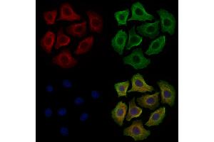 ABIN6260430 and ABIN6279214 staining Hela cells by IF/ICC. (CAMK2D 抗体  (C-Term))