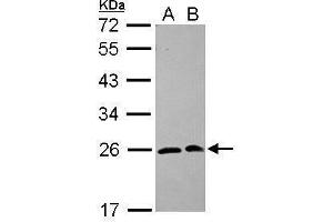 WB Image Sample (30 ug of whole cell lysate) A: 293T B: A431 12% SDS PAGE antibody diluted at 1:1000 (SAR1A 抗体  (Center))