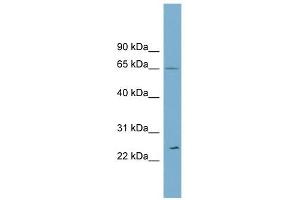 Ribophorin II antibody used at 1 ug/ml to detect target protein. (Ribophorin II 抗体  (Middle Region))