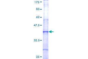 Coagulation Factor V Protein (F5) (AA 29-128) (GST tag)