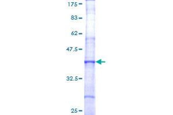 Coagulation Factor V Protein (F5) (AA 29-128) (GST tag)