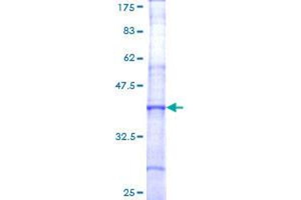 Coagulation Factor V Protein (F5) (AA 29-128) (GST tag)