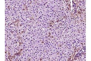 Paraformaldehyde-fixed, paraffin embedded rat liver, Antigen retrieval by boiling in sodium citrate buffer (pH6) for 15min, Block endogenous peroxidase by 3% hydrogen peroxide for 30 minutes, Blocking buffer (normal goat serum) at 37°C for 20min, Antibody incubation with Apolipoprotein E Polyclonal Antibody, Unconjugated  at 1:400 overnight at 4°C, followed by a conjugated secondary and DAB staining. (APOE 抗体  (AA 151-250))