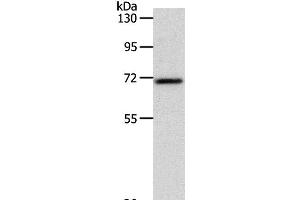 Western Blot analysis of Mouse liver tissue using SOX-13 Polyclonal Antibody at dilution of 1:800 (SOX13 抗体)