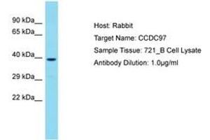 Image no. 1 for anti-Coiled-Coil Domain Containing 97 (CCDC97) (C-Term) antibody (ABIN6750718) (CCDC97 抗体  (C-Term))