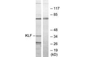 Western blot analysis of extracts from Jurkat cells, treated with serum 20% 15', using KLF Antibody. (KLF 抗体  (AA 291-340))