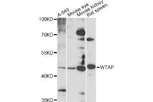 Western blot analysis of extracts of various cell lines, using WTAP antibody (ABIN6291068) at 1:1000 dilution. (WTAP 抗体)