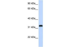 WB Suggested Anti-C21orf62 Antibody Titration:  0. (C21orf62 抗体  (Middle Region))