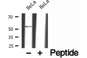 Western blot analysis of extracts of HeLa cells, using FAF2 antibody. (FAF2 抗体  (Internal Region))