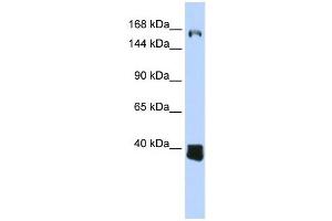 C10ORF12 antibody used at 1 ug/ml to detect target protein. (Lcor 抗体  (Middle Region))