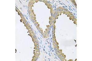 Immunohistochemistry of paraffin-embedded human prostate using ABL1 antibody. (ABL1 抗体)