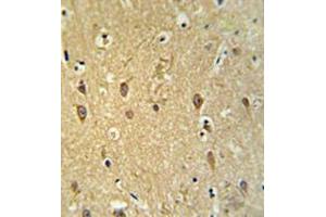 Immunohistochemistry analysis in brain tissue (formalin-fixed, paraffin-embedded) using GPR17 Antibody , followed by peroxidase conjugation of the secondary antibody and DAB staining. (GPR17 抗体  (Middle Region))