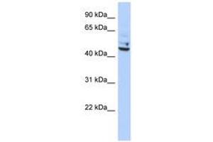 Image no. 1 for anti-Tumor Protein P53 Inducible Protein 13 (TP53I13) (C-Term) antibody (ABIN6741108) (TP53I13 抗体  (C-Term))