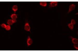 ABIN6276630 staining HeLa by IF/ICC. (IL7R 抗体  (N-Term))