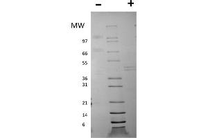 SDS-PAGE of Mouse Interleukin-12 Recombinant Protein SDS-PAGE of Mouse Interleukin-12 Recombinant Protein. (IL12 蛋白)