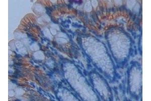 Immunohistochemistry (IHC) image for anti-Basigin (Ok Blood Group) (BSG) (AA 87-323) antibody (ABIN7441883)
