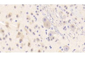 Immunohistochemistry (IHC) image for anti-Low Density Lipoprotein Receptor Adaptor Protein 1 (LDLRAP1) (AA 1-308) antibody (ABIN7440986)