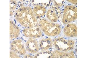 Immunohistochemistry of paraffin-embedded Human kidney using KHK Polyclonal Antibody at dilution of 1:100 (40x lens). (Ketohexokinase 抗体)