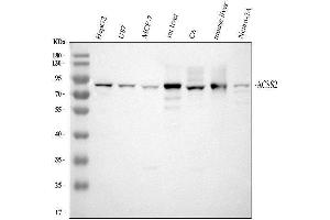 Western blot analysis of ACSS2 using anti-ACSS2 antibody (ABIN7600569).
