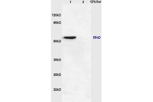 Lane 1: mouse brain lysates Lane 2: mouse heart lysates probed with Anti NFKBIE/IKB epsilon Polyclonal Antibody, Unconjugated (ABIN1386753) at 1:200 in 4 °C. (NFKBIE 抗体  (AA 165-270))