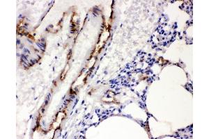 IHC analysis of VWF using anti-VWF antibody (ABIN3042349).