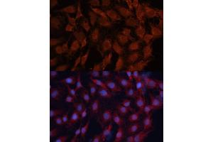 Immunofluorescence analysis of C6 cells using DN antibody (ABIN6130336, ABIN6139701, ABIN6139702 and ABIN7101774) at dilution of 1:100. (DNAJB1 抗体  (AA 1-340))