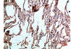 Immunohistochemical analysis of paraffin-embedded human-lung, antibody was diluted at 1:200 (CD236/GYPC 抗体  (AA 11-60))