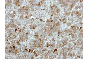 IHC-P Image Immunohistochemical analysis of paraffin-embedded MCF7 xenograft, using TBCK, antibody at 1:100 dilution. (TBCK 抗体)