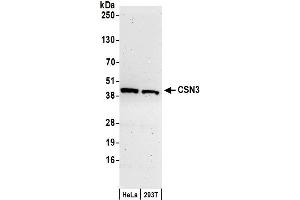 anti-Casein kappa (CSN3) (AA 325-375) antibody