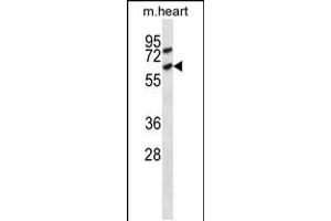 Western blot analysis in mouse heart tissue lysates (35ug/lane). (ACVR1C/ALK7 抗体  (C-Term))