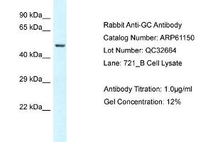 Western Blotting (WB) image for anti-Gc (N-Term) antibody (ABIN2788696) (Gc (N-Term) 抗体)