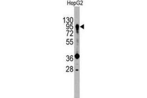 Western Blotting (WB) image for anti-Prospero Homeobox 1 (PROX1) antibody (ABIN3001422) (PROX1 抗体)