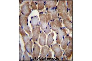 Immunohistochemistry analysis in Formalin Fixed, Paraffin Embedded Human skeletal muscle tissue stained with SEPN1 antibody (C-term) followed by peroxidase conjugation of the secondary antibody and DAB staining. (SEPN1 抗体  (C-Term))