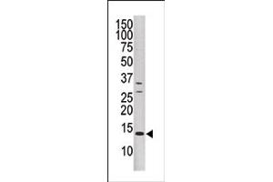Image no. 1 for anti-Dual Specificity Phosphatase 15 (DUSP15) (N-Term) antibody (ABIN360796) (DUSP15 抗体  (N-Term))