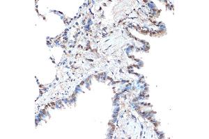 Immunohistochemistry (IHC) image for anti-REST Corepressor 1 (RCOR1) antibody (ABIN7269920)