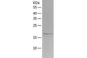 Western Blotting (WB) image for PR Domain Containing 2, with ZNF Domain (PRDM2) (AA 2-200) protein (His tag) (ABIN7287056) (PRDM2 Protein (AA 2-200) (His tag))