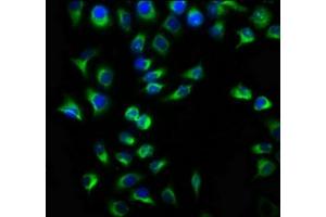Immunofluorescence staining of A549 cells with ABIN7173043 at 1:133, counter-stained with DAPI. (TMEM127 抗体  (AA 1-95))