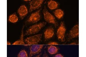 Immunofluorescence analysis of HeLa cells using MTMR9 Polyclonal Antibody at dilution of 1:100. (MTMR9 抗体)