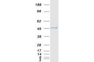 Western Blotting (WB) image for SET and MYND Domain Containing 3 (SMYD3) protein (Myc-DYKDDDDK Tag) (ABIN2732274)